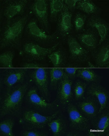 Immunohistochemistry of paraffin-embedded Rat kidney using TPI1 Polyclonal Antibody at dilution of 1:100 (40x lens).