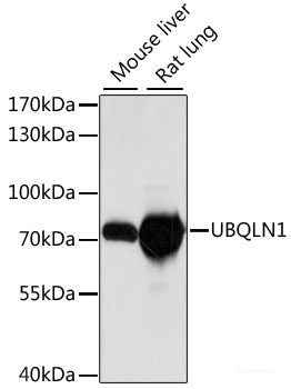 Western blot analysis of extracts of Rat liver using ZNF134 Polyclonal Antibody at dilution of 1:1000.