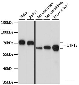 Western blot analysis of extracts of various cell lines using RIOK3 Polyclonal Antibody at dilution of 1:1000.