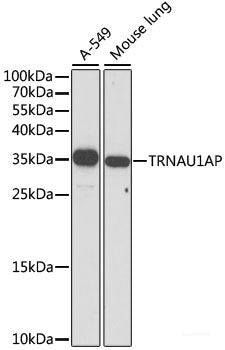 Immunofluorescence analysis of MCF7 cells using SKAP2 Polyclonal Antibody