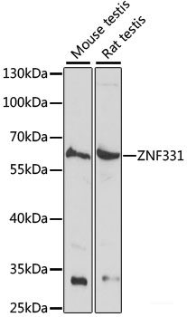 Western blot analysis of extracts of various cell lines using MED20 Polyclonal Antibody at dilution of 1:1000.