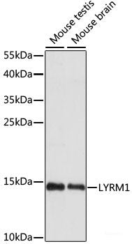 Immunohistochemistry of paraffin-embedded Mouse spleen using BTK Polyclonal Antibody at dilution of 1:100 (40x lens).