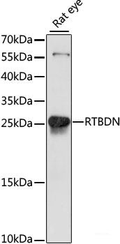 Western blot analysis of extracts of various cell lines using Factor IX / F9 Polyclonal Antibody at dilution of 1:1000.