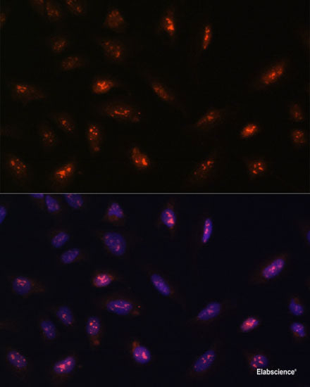 Western blot analysis of extracts of Rat ovary using POLR3C Polyclonal Antibody at dilution of 1:1000.
