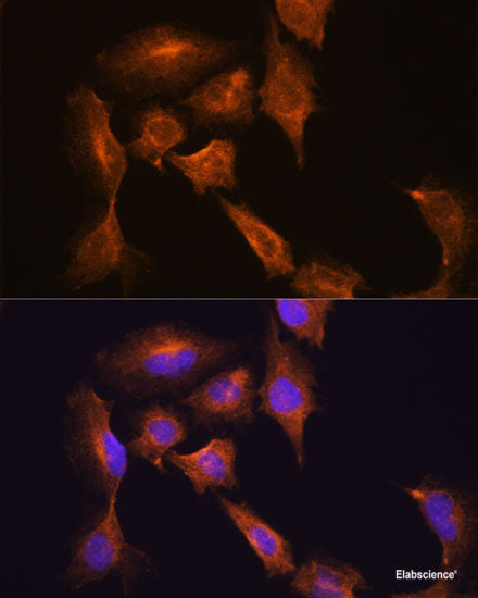 Immunofluorescence analysis of L929 cells using AVIL Polyclonal Antibody at dilution of 1:100. Blue: DAPI for nuclear staining.