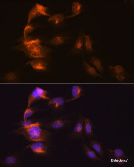 Immunohistochemistry of paraffin-embedded Rat heart using KIF1C Polyclonal Antibody at dilution of 1:100 (40x lens).