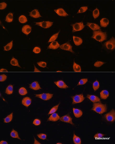 Western blot analysis of extracts of various cell lines using HLA-DRA Polyclonal Antibody at dilution of 1:1000.