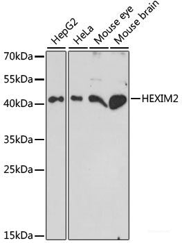 Immunofluorescence analysis of U2OS cells using DICER1 Polyclonal Antibody at dilution of 1:100. Blue: DAPI for nuclear staining.