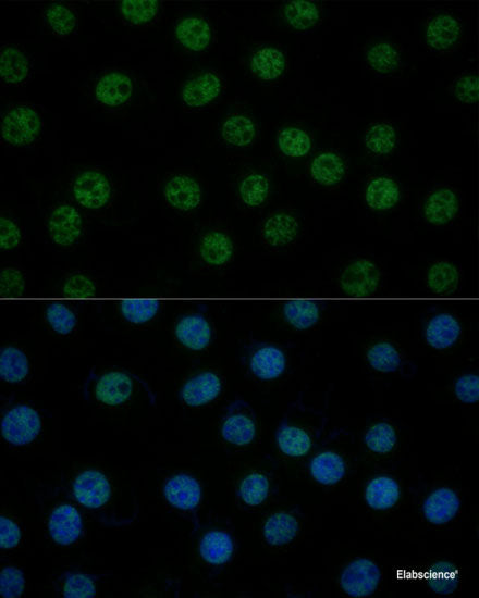 Western blot analysis of extracts from normal (control) and HSP90AB1 knockout (KO) HeLa cells using HSP90AB1 Polyclonal Antibody at dilution of 1:1000.