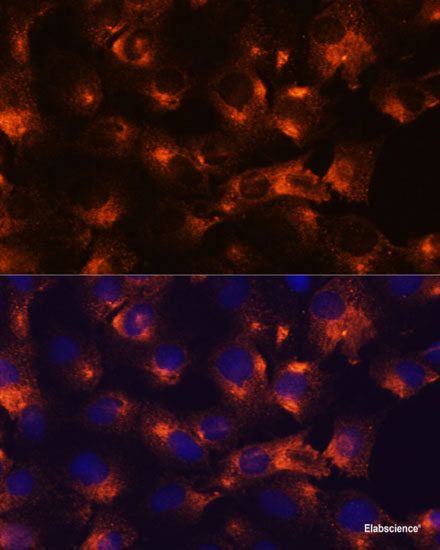 Western blot analysis of extracts of various cell lines using PTPN2 Polyclonal Antibody at dilution of 1:1000.