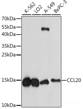 Western blot analysis of extracts of Mouse liver using GABRB2 Polyclonal Antibody at dilution of 1:1000.