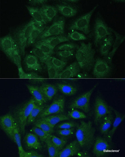 Western blot analysis of extracts of various cell lines using RUVBL2 Polyclonal Antibody at dilution of 1:1000.