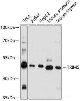 Western blot analysis of extracts of K-562 cells using CCNT1 Polyclonal Antibody.