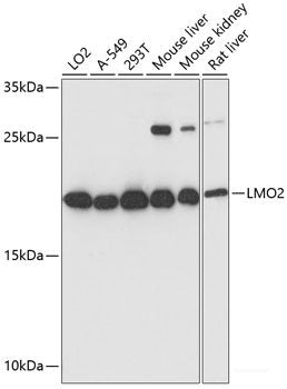Immunohistochemistry of paraffin-embedded Rat spleen using FGFR2 Polyclonal Antibody at dilution of 1:100 (40x lens).