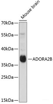 Immunofluorescence analysis of HeLa cells using SPAM1 Polyclonal Antibody