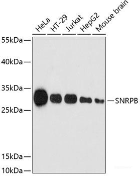 Western blot analysis of extracts of various cell lines using HCLS1 Polyclonal Antibody at dilution of 1:1000.