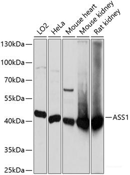 Western blot analysis of extracts of various cell lines using HLA-DQA1 Polyclonal Antibody at dilution of 1:1000.