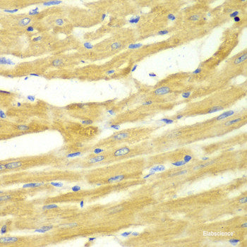 Immunohistochemistry of paraffin-embedded Rat kidney using MT1-MMP Polyclonal Antibody at dilution of 1:100 (40x lens).
