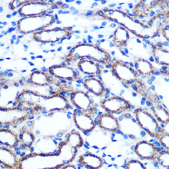 Immunohistochemistry of paraffin-embedded Human stomach using RETN Polyclonal Antibody at dilution of 1:100 (40x lens).