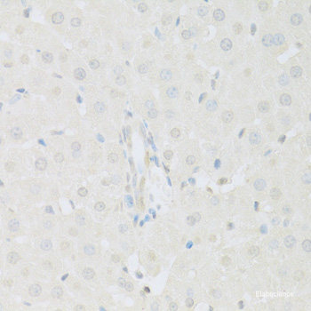 Western blot analysis of extracts of Mouse kidney using PAK1 Polyclonal Antibody at dilution of 1:1000.