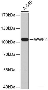 Immunohistochemistry of paraffin-embedded Rat spleen using CDK20 Polyclonal Antibody at dilution of 1:200 (40x lens).