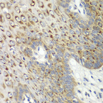Immunohistochemistry of paraffin-embedded Rat pancreatic islet using DLK1 Polyclonal Antibody at dilution of 1:200 (40x lens).