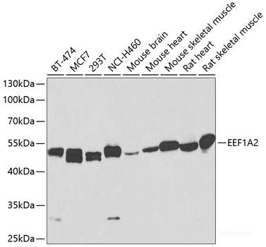 Western blot analysis of extracts of various cell lines using HMOX2 Polyclonal Antibody at dilution of 1:400.