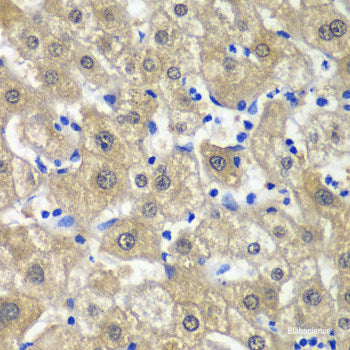 Western blot analysis of extracts of Mouse liver using HNF1A Polyclonal Antibody.