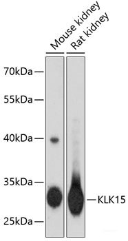 Western blot analysis of extracts of various cell lines using Asymmetric DiMethyl-Histone H3-R8 Polyclonal Antibody.