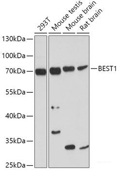 Western blot analysis of extracts of various cell lines using AMPD1 Polyclonal Antibody at dilution of 1:3000.