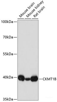 Western blot analysis of extracts of Mouse brain using PPP3CB Polyclonal Antibody at dilution of 1:1000.