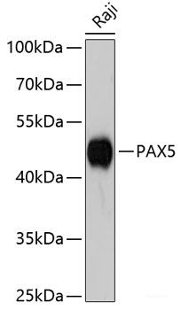 Immunofluorescence analysis of Y79 cells using ANO2 Polyclonal Antibody at dilution of 1:100 (40x lens). Blue: DAPI for nuclear staining.
