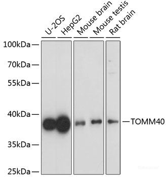 Immunohistochemistry of paraffin-embedded Human lung cancer using IFIT3 Polyclonal Antibody at dilution of 1:100 (40x lens).