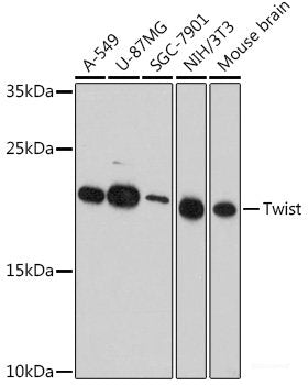 Immunohistochemistry of paraffin-embedded Human liver damage using ITPKB Polyclonal Antibody at dilution of 1:100 (40x lens).