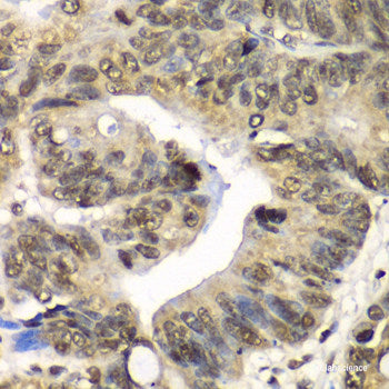 Immunohistochemistry of paraffin-embedded Rat brain using LCAT Polyclonal Antibody at dilution of 1:100 (40x lens).