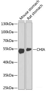 Western blot analysis of extracts of various cell lines using TPM4 Polyclonal Antibody at dilution of 1:1000.