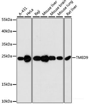 Immunohistochemistry of paraffin-embedded Rat brain using VARS Polyclonal Antibody at dilution of 1:100 (40x lens).