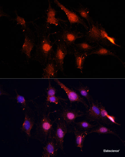 Western blot analysis of extracts of Mouse testis using DNALI1 Polyclonal Antibody at dilution of 1:1000.