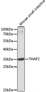 Western blot analysis of extracts of K-562 cells using IFITM1 Polyclonal Antibody at dilution of 1:1000.