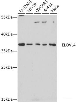 Immunofluorescence analysis of U2OS cells using FXR2 Polyclonal Antibody at dilution of 1:100. Blue: DAPI for nuclear staining.