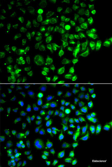 Immunofluorescence analysis of Rat lung using ABCG1 Polyclonal Antibody at dilution of 1:100. Blue: DAPI for nuclear staining.