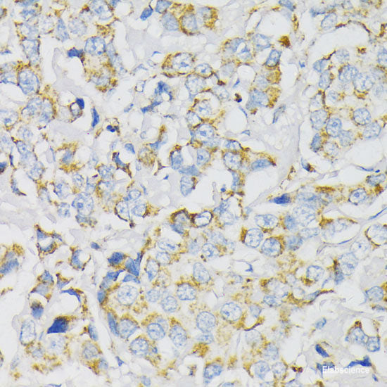 Immunohistochemistry of paraffin-embedded Rat brain using TRAP1 Polyclonal Antibody at dilution of 1:100 (40x lens).