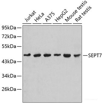 Immunohistochemistry of paraffin-embedded Rat lung using CRTAP Polyclonal Antibody at dilution of 1:100 (40x lens).