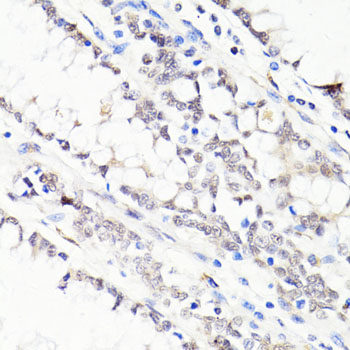 Western blot analysis of extracts of various cell lines using LARP1 Polyclonal Antibody at dilution of 1:1000.