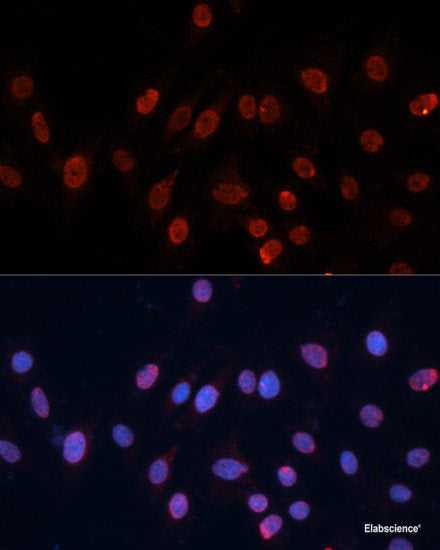 Western blot analysis of extracts of various cell lines using APPL1 Polyclonal Antibody at dilution of 1:1000.