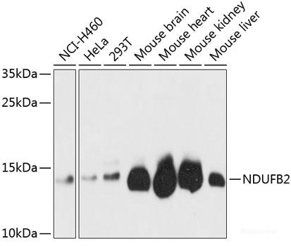 Western blot analysis of extracts of B-cell cells using TBX21 Polyclonal Antibody at dilution of 1:1000.