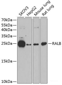 Western blot analysis of extracts of A-431 cells using PAK6 Polyclonal Antibody.