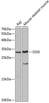 Western blot analysis of extracts of various cell lines using MRPL11 Polyclonal Antibody at dilution of 1:1000.