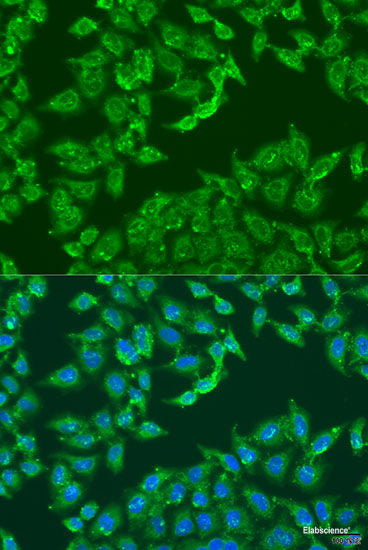 Immunohistochemistry of paraffin-embedded Human prostate using NOV Polyclonal Antibody at dilution of 1:100 (40x lens).