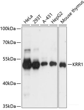 Immunohistochemistry of paraffin-embedded Rat brain using PRKACB Polyclonal Antibody at dilution of 1:100 (40x lens).